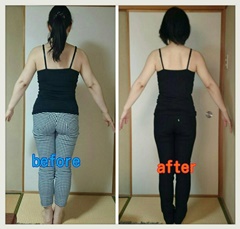 骨盤矯正ダイエット